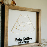 Ultrasound Keepsake Frame