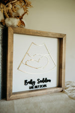 Load image into Gallery viewer, Ultrasound Keepsake Frame

