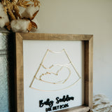 Ultrasound Keepsake Frame