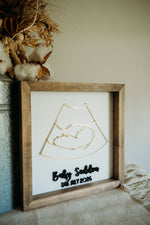 Load image into Gallery viewer, Ultrasound Keepsake Frame
